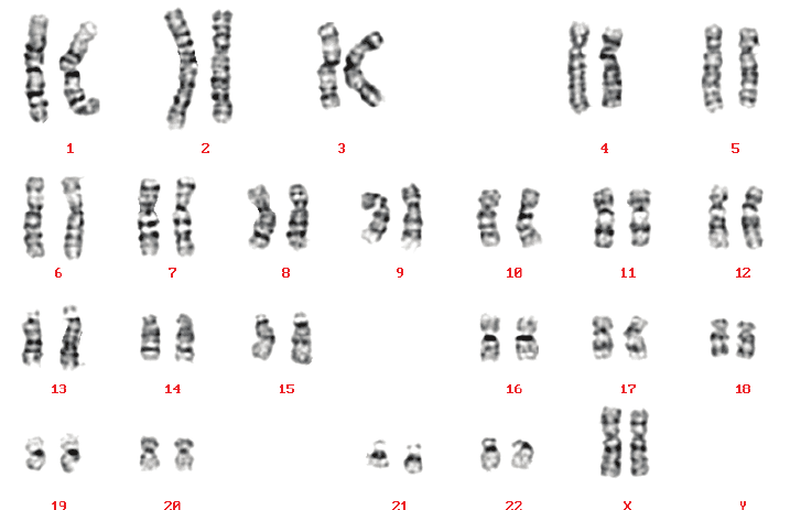 Identify Karyotype Mutations
