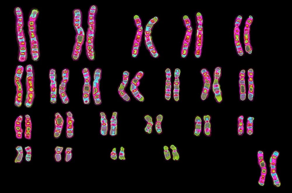 Chromosomes & Karyotypes Quiz