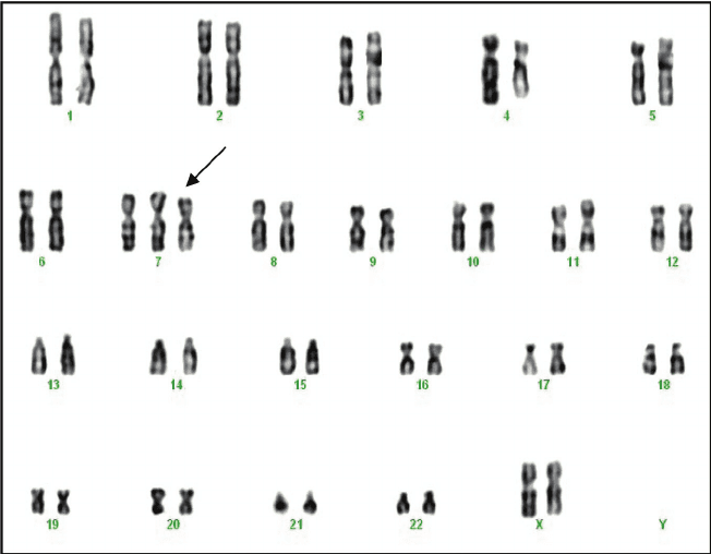Karyotyping in Cancer: Applications & Analysis Quiz