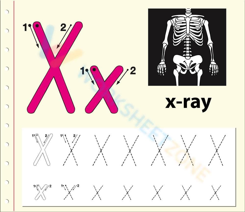 X is for X-ray - Page 1